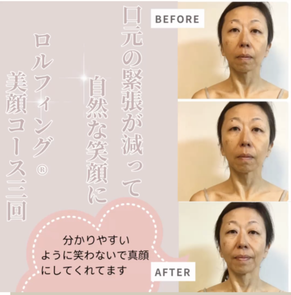 表情 Before/After