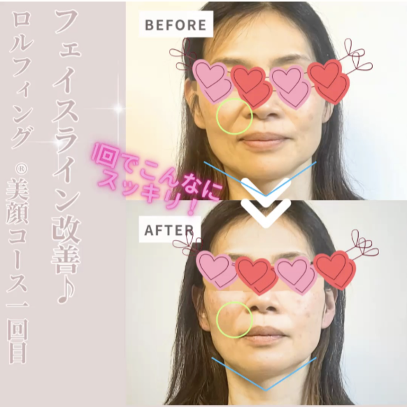 輪郭 Before/After