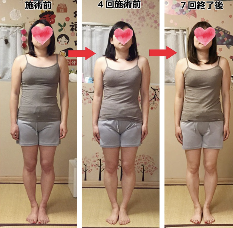 全身 Before/After（正面）