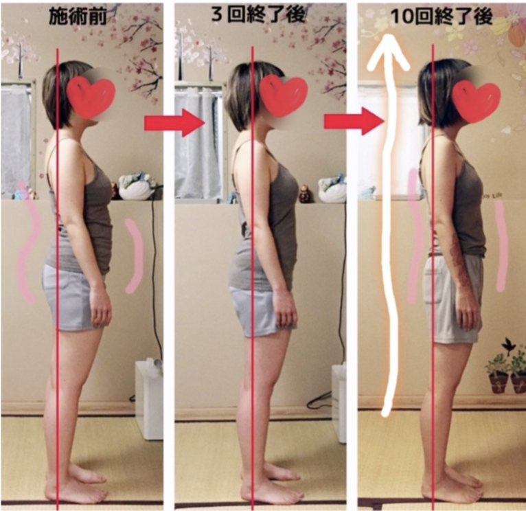 全身 Before/After（側面）